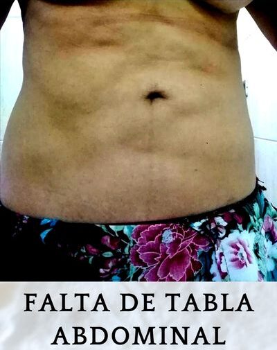 post-operatorios 2